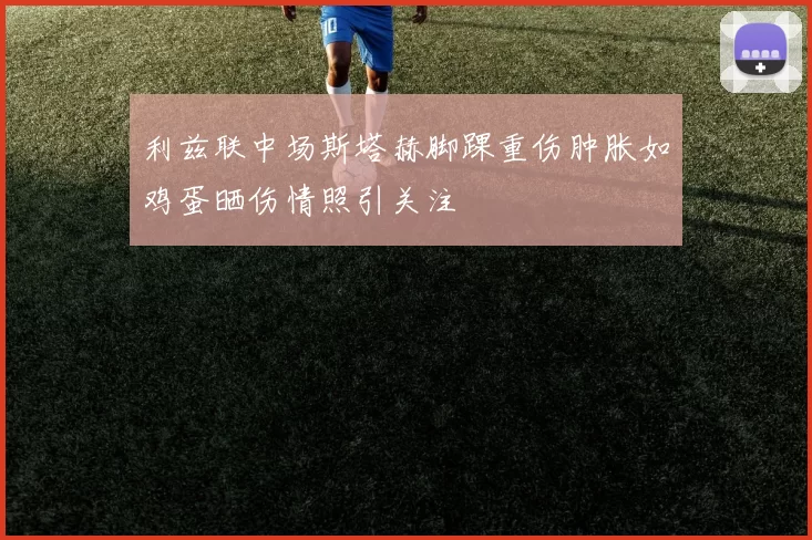 利兹联中场斯塔赫脚踝重伤肿胀如鸡蛋晒伤情照引关注